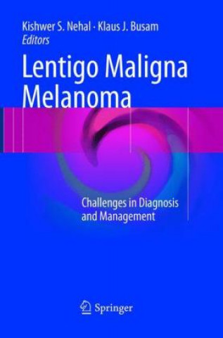 Könyv Lentigo Maligna Melanoma Kishwer S. Nehal