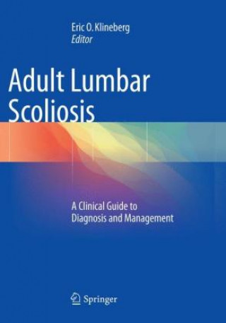 Kniha Adult Lumbar Scoliosis Eric O. Klineberg