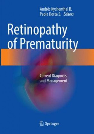 Knjiga Retinopathy of Prematurity Andrés Kychenthal B.