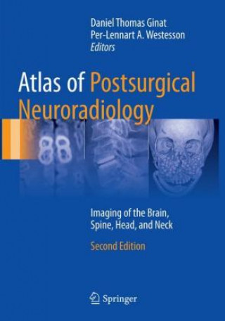 Kniha Atlas of Postsurgical Neuroradiology Daniel Thomas Ginat