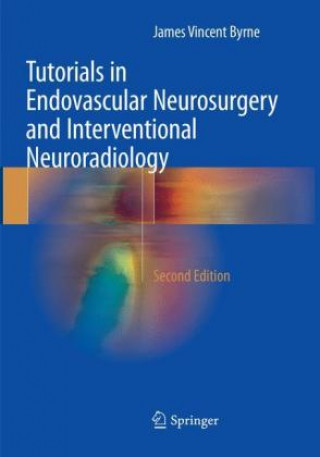 Kniha Tutorials in Endovascular Neurosurgery and Interventional Neuroradiology James Vincent Byrne