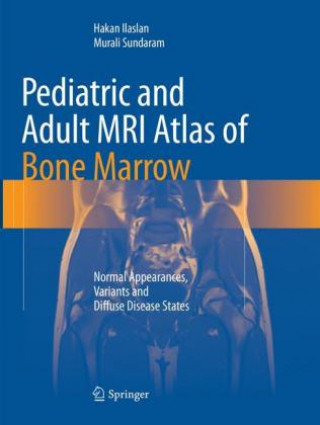 Carte Pediatric and Adult MRI Atlas of Bone Marrow Hakan Ilaslan