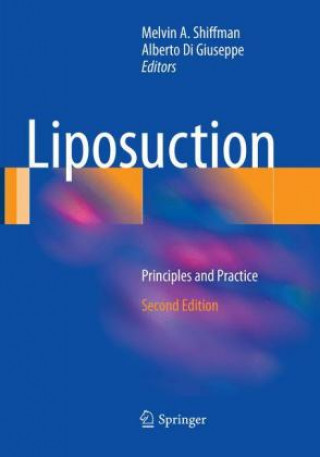 Книга Liposuction Melvin A. Shiffman