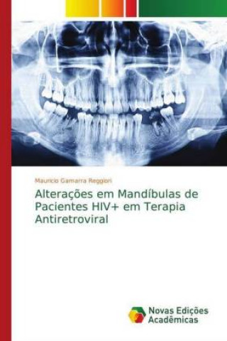 Kniha Alteracoes em Mandibulas de Pacientes HIV+ em Terapia Antiretroviral Mauricio Gamarra Reggiori