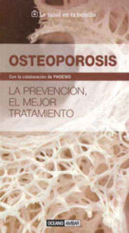 Kniha Osteoporosis 