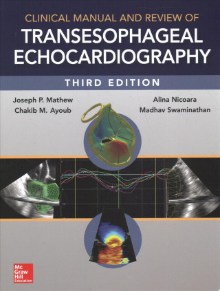 Könyv Clinical Manual and Review of Transesophageal Echocardiography, 3/e Joseph Mathew