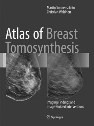 Knjiga Atlas of Breast Tomosynthesis Martin Sonnenschein