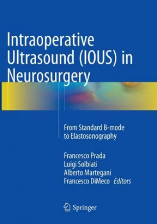 Carte Intraoperative Ultrasound (IOUS) in Neurosurgery Francesco Prada