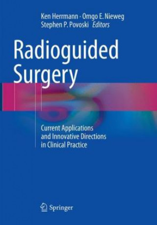 Carte Radioguided Surgery Ken Herrmann