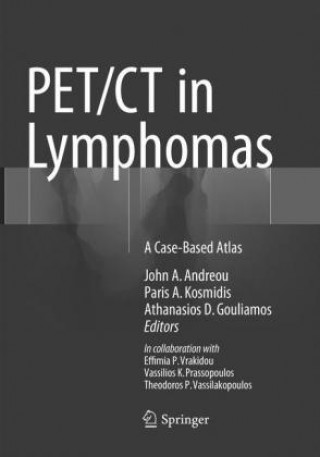 Carte PET/CT in Lymphomas John A. Andreou