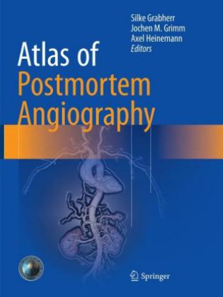 Książka Atlas of Postmortem Angiography Silke Grabherr