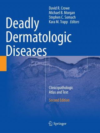 Könyv Deadly Dermatologic Diseases David R. Crowe