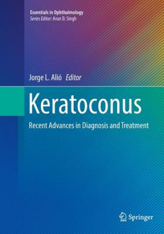 Książka Keratoconus Jorge L. Alió