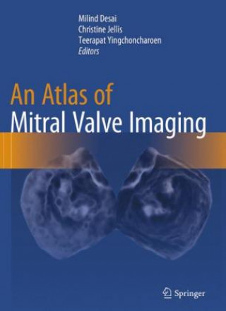 Knjiga Atlas of Mitral Valve Imaging Milind Desai