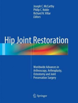 Carte Hip Joint Restoration Joseph C. McCarthy