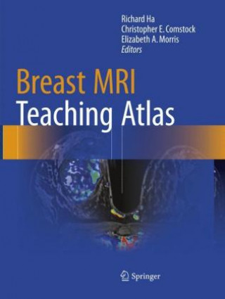 Carte Breast MRI Teaching Atlas Richard Ha