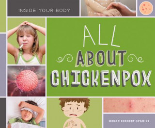 Kniha All about Chickenpox Megan Borgert-Spaniol