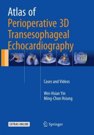 Kniha Atlas of Perioperative 3D Transesophageal Echocardiography Wei-Hsian Yin