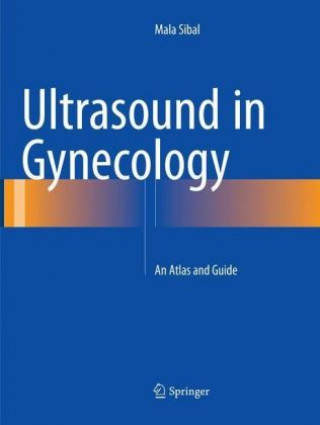 Kniha Ultrasound in Gynecology Mala Sibal