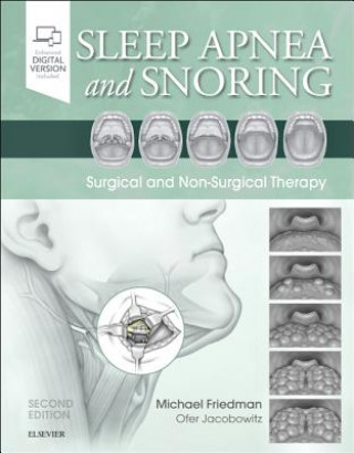 Kniha Sleep Apnea and Snoring Michael Friedman