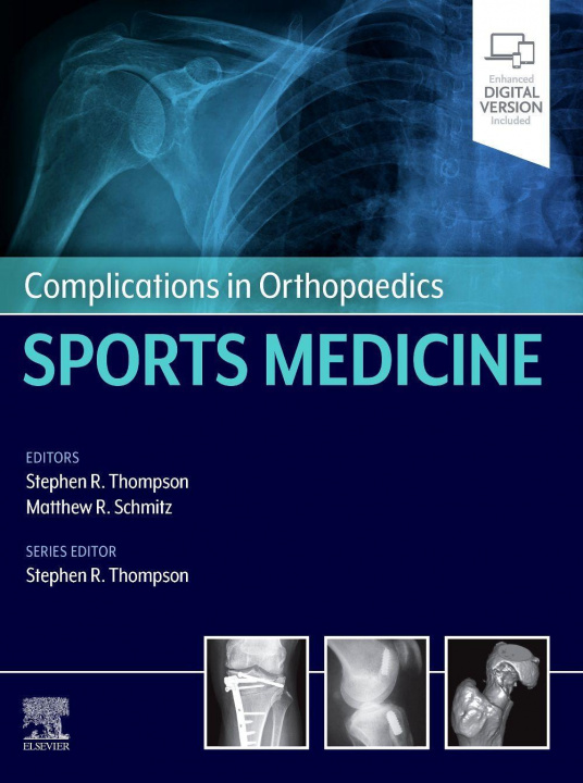 Kniha Complications in Orthopaedics: Sports Medicine Stephen Thompson
