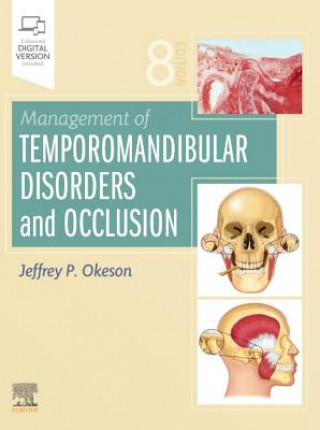 Kniha Management of Temporomandibular Disorders and Occlusion Jeffrey P. Okeson