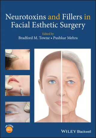 Carte Neurotoxins and Fillers in Facial Esthetic Surgery Bradford M. Towne