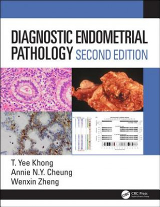 Carte Diagnostic Endometrial Pathology 2E KHONG