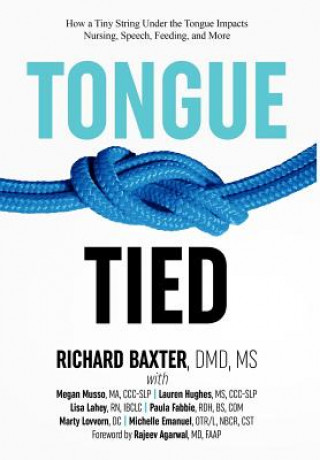 Könyv Tongue-Tied DMD MS Richard Baxter