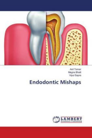 Kniha Endodontic Mishaps Anil Tomer