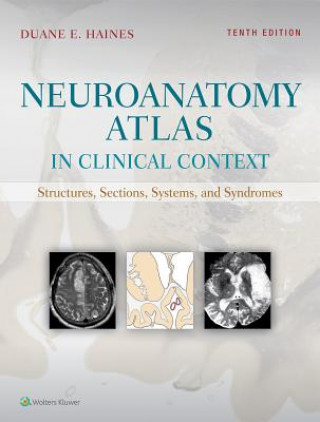 Carte Neuroanatomy Atlas in Clinical Context: Structures, Sections, Systems, and Syndromes Duane E. Haines