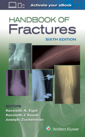 Könyv Handbook of Fractures Egol