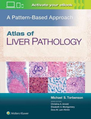 Kniha Atlas of Liver Pathology: A Pattern-Based Approach Michael Torbenson