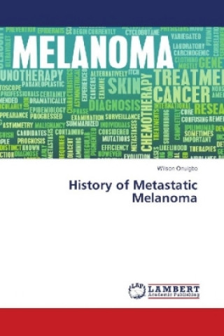Könyv History of Metastatic Melanoma Wilson Onuigbo