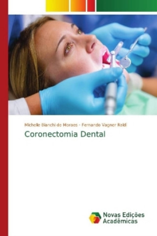 Kniha Coronectomia Dental Michelle Bianchi de Moraes