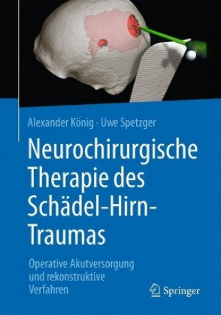 Book Neurochirurgische Therapie des Schadel-Hirn-Traumas Alexander König