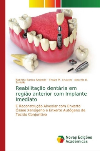 Kniha Reabilitacao dentaria em regiao anterior com Implante Imediato Roberta Barros Andrade