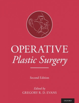 Kniha Operative Plastic Surgery Gregory Evans