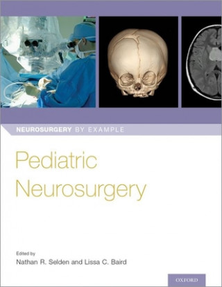 Könyv Pediatric Neurosurgery Nathan Selden