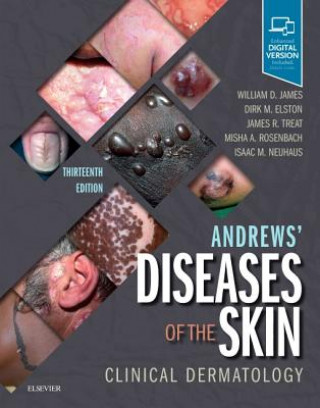 Kniha Andrews' Diseases of the Skin James