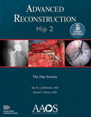 Könyv Advanced Reconstruction: Hip 2: Print + Ebook with Multimedia Jay R. Lieberman