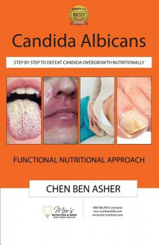 Carte Candida Albicans: Step by Step to Defeat Candida Overgrowth Nutritionally Chen Ben Asher