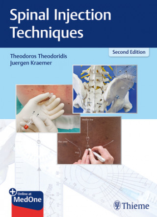 Kniha Spinal Injection Techniques Theodoros Theodoridis