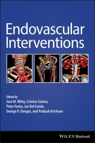 Книга Endovascular Interventions JOSE WILEY