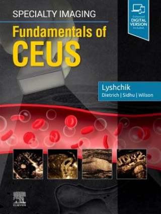 Kniha Specialty Imaging: Fundamentals of CEUS Lyshchik