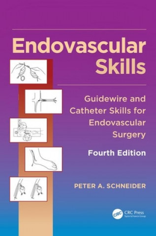 Carte Endovascular Skills Schneider