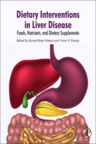 Kniha Dietary Interventions in Liver Disease Ronald Watson