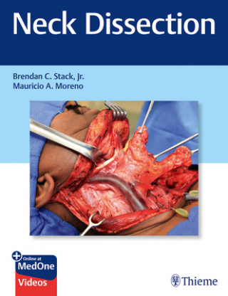 Könyv Neck Dissection Brendan Stack