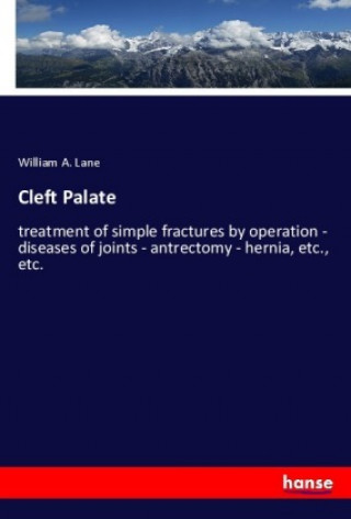 Книга Cleft Palate William A. Lane