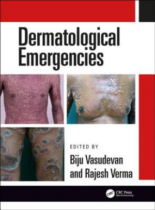 Könyv Dermatological Emergencies VASUDEVAN